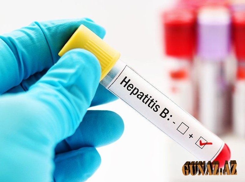 Ölkədə neçə nəfər hepatit xəstəsidir?