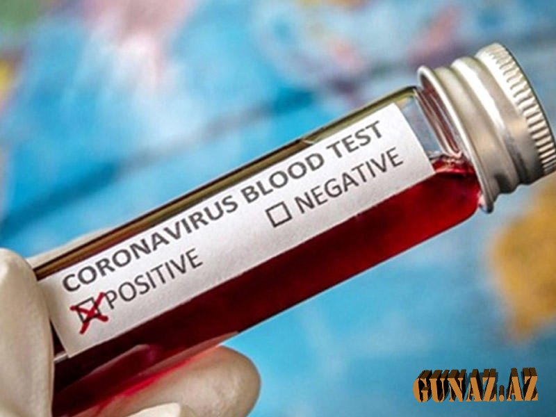 Türkiyə koronavirusun daha bir müalicə üsulunu tapdı - 15 dəqiqə ərzində...