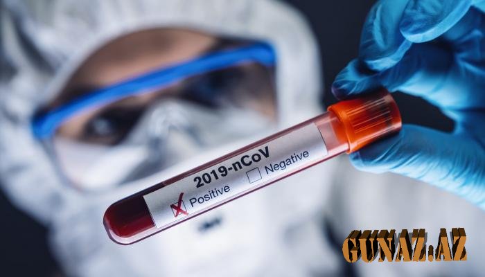 Azərbaycanda daha 521 nəfər koronavirusa yoluxdu, 6 nəfər öldü