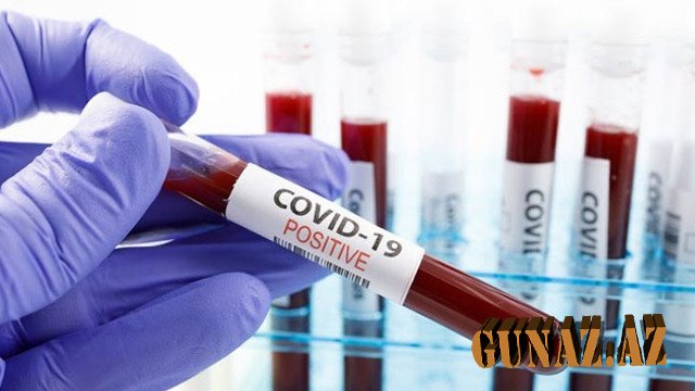 Daha 154 nəfər koronavirusa yoluxdu, 139 nəfər sağaldı