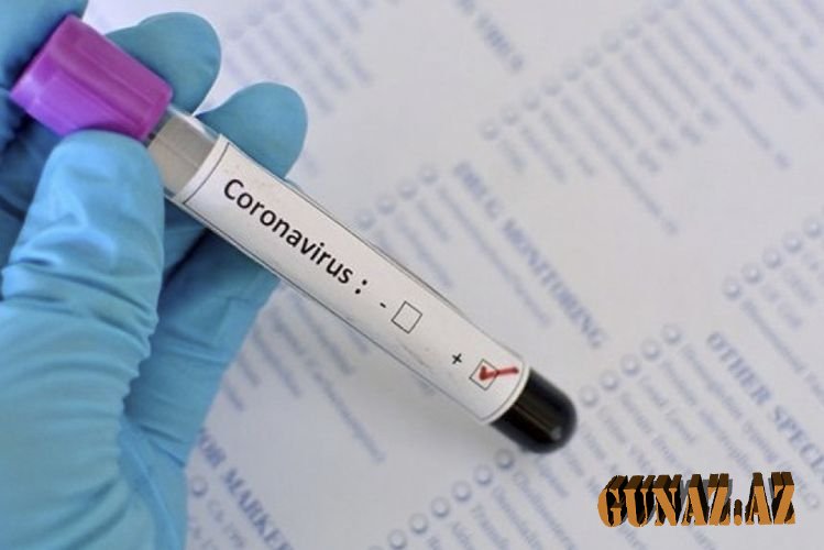 Daha 162 nəfər koronavirusa yoluxdu: ölən var