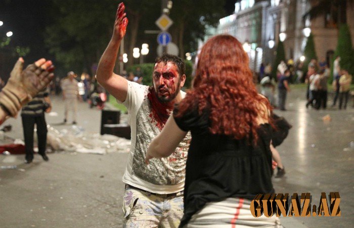 Gürcüstandakı qarşıdurmalarda 240 nəfər yaralanıb