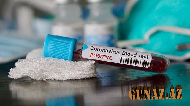 Kiyevdən qayıdan 29 nəfərdə koronavirus tapıldı