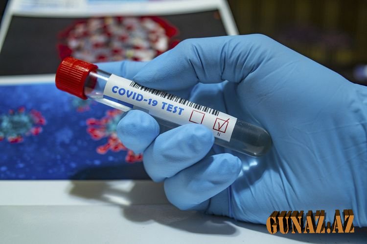 Azərbaycanda daha 338 nəfər koronaya yoluxdu, 4 nəfər öldü
