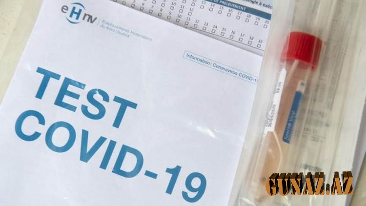 COVID-19 testinin cavabı gecikən şəxslər nə etməlidir? - RƏSMİ AÇIQLAMA