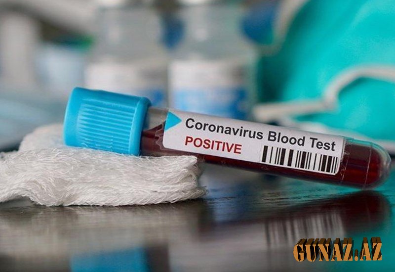 Azərbaycanda koronavirusa yoluxanların sayında kəskin azalma