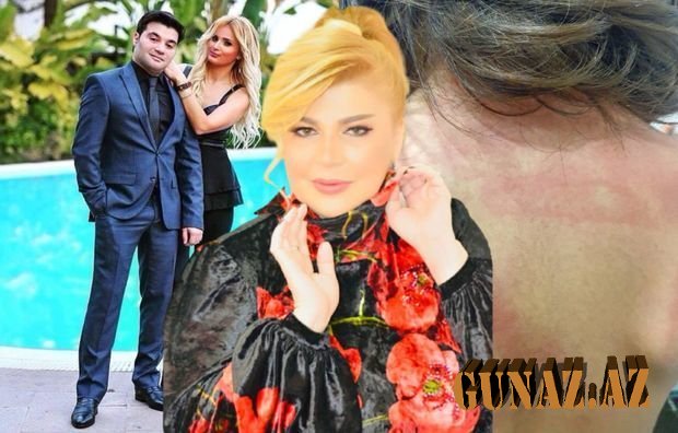 Mətanət İsgəndərlinin gəlini kirayə qaldığı evdən qovuldu: “Dörd ev, dörd maşını var”