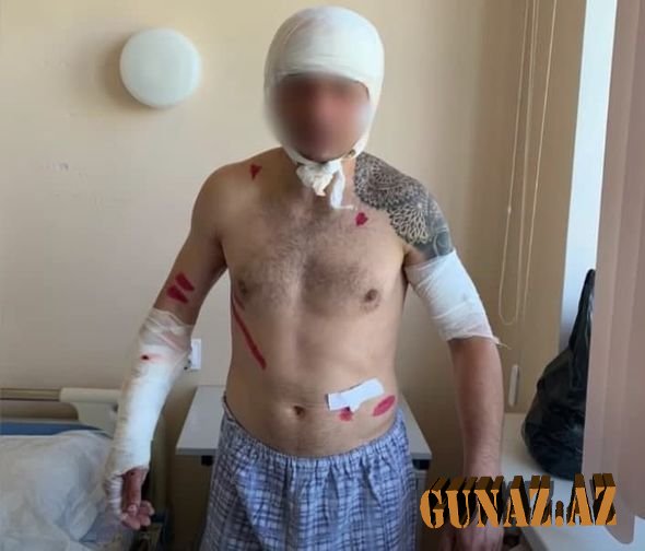 Ayının pəncəsindən belə XİLAS OLDU