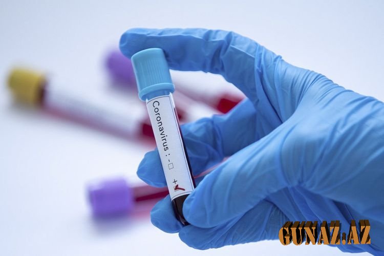 Koronavirusla bağlı günün statistikası açıqlandı