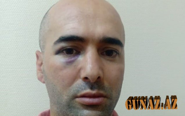 Xəstəxanada döyüldüyü deyilən Qarabağ qazisi ilə bağlı AÇIQLAMA