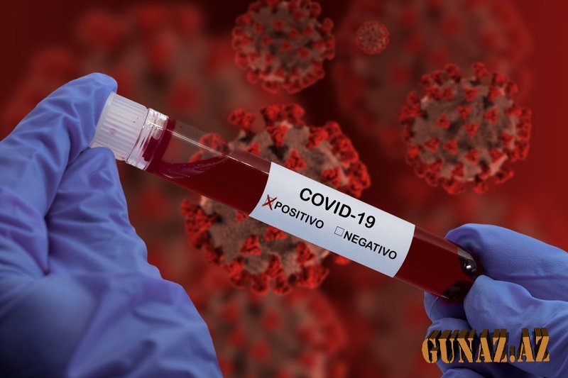 Azərbaycanda koronavirusa yoluxanların sayı açıqlandı