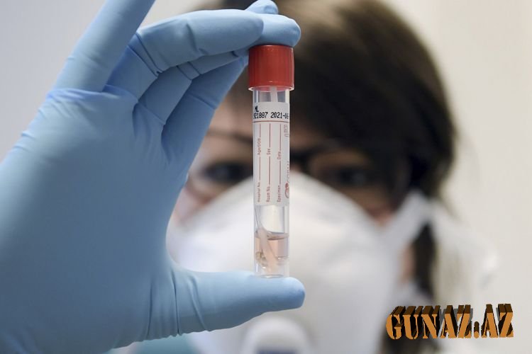 Azərbaycanda koronavirus uşaqlar arasında geniş yayılıb?