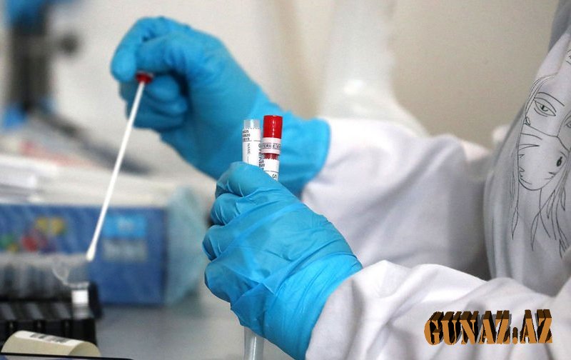 Koronavirusla bağlı günün statistikası açıqlandı