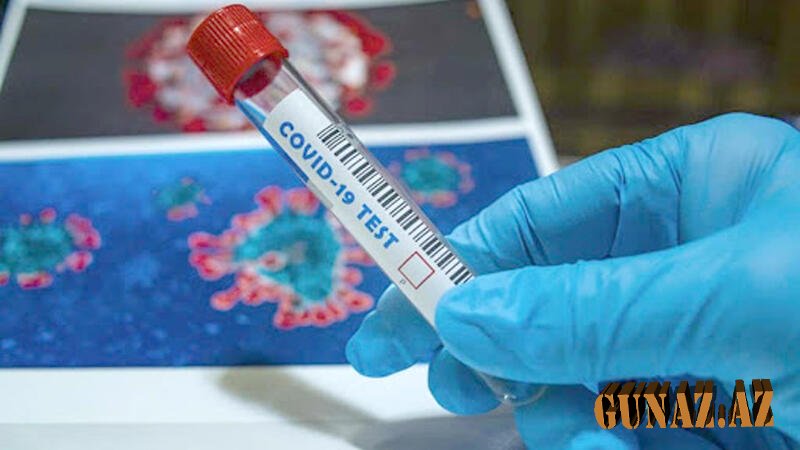 Koronavirusla bağlı günün statistikası açıqıandı