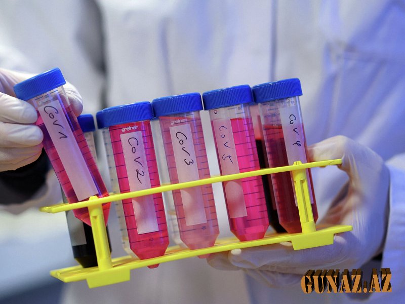 Koronavirusla bağlı günün statistikası açıqlandı