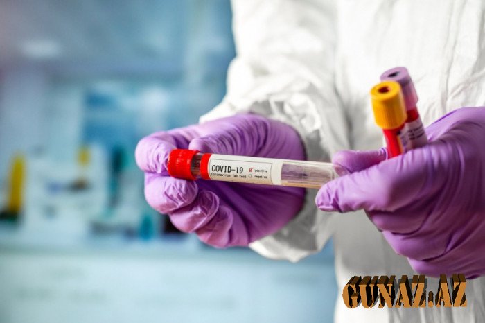 Koronavirusla bağlı günün statistikası açıqlandı