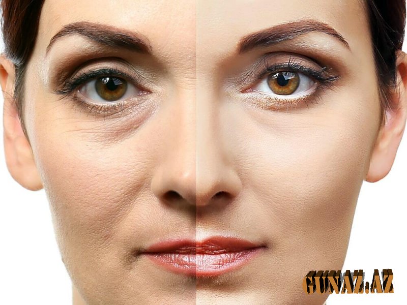 Hansı amillər dərini qırışdırır?