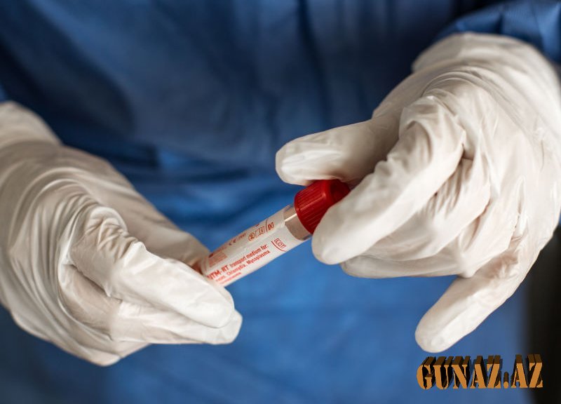 Günün koronavirus statistikası açıqlandı
