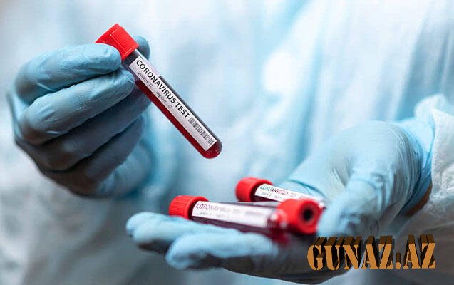 Günün koronavirus statistikası açıqlandı