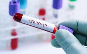 COP29-a gələn qonaqlardan koronavirus testi götürülməyəcək