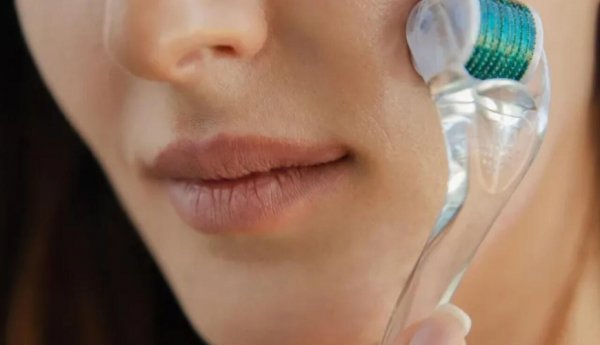 Saç əkdirməyə ehtiyac yoxdur - 3 aya tük çıxardır