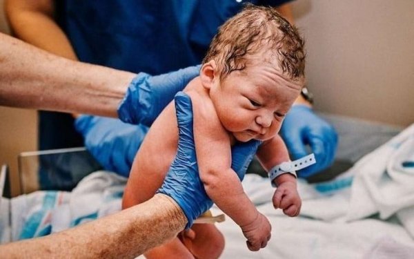 7 kiloqramlıq körpə doğuldu-İLK HADİSƏ