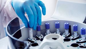 Afrikada  vəba epidemiyasının yayıldığı açıqlandı