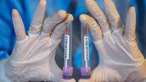 ÜST-dən hantavirus açıqlaması gəldi