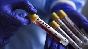 ABŞ Ebola epidemiyası ilə bağlı həyəcan təbili çaldı