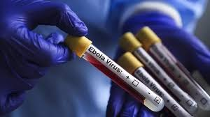 Ebola ilə mübarizədə kritik məqam: ÜST rəsmisindən etiraf